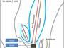 Pistenplan Sinswang (Oberstaufen)