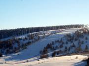 Zwischen den Bäumen wartet viel Spaß für Freerider