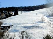 Wellige Abfahrt am Scheuermattlift