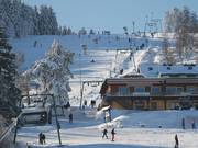 Oberer Wilddieblift - Schlepplift mit T-Bügel/Anker