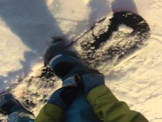 B. Martock T-Bar
